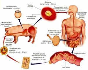 principais verminoses humanas - doenças causadas por vermes: sintomas