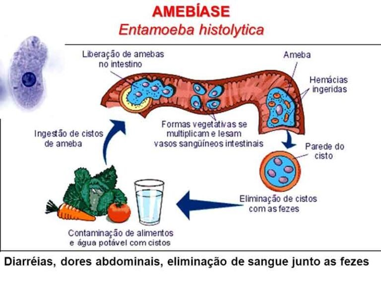 Principais doenças causadas por protozoários Biologia