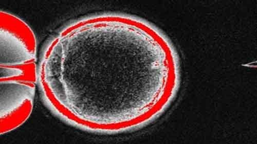 Clonagem: o que é, humana,terapêutica, reprodutiva, tipos, importância