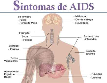 Sinais de infecção por hiv aids