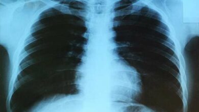 Como os pulmões funcionam, estruturas, qual a sua importância e suas funções