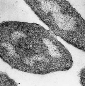 Fotomicrografia de bactérias ao microscópio eletrônico de transmissão com técnica de autorradiografi a.