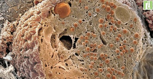 células do pâncreas