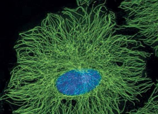 citoesqueleto microtúbulos que aparecem em verde