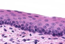 características do tecido epitelial de revestimento e glandular