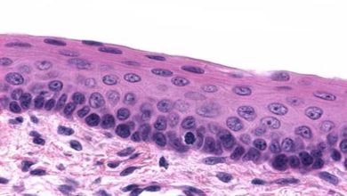 características do tecido epitelial de revestimento e glandular