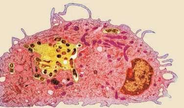 Macrófago observado no microscópio