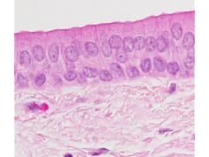 Características do Tecido Epitelial: revestimento e glandular